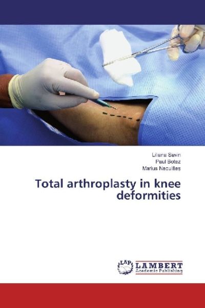 Total arthroplasty in knee deformities - LAP Lambert Acade...