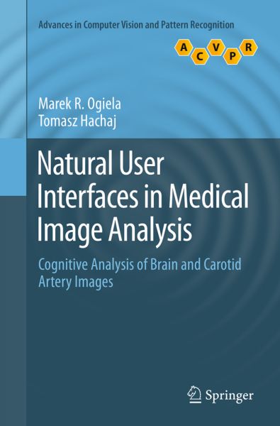 Natural User Interfaces in Medical Image Analysis: Cognitive Analysis of Brain and Carotid Artery Im - Springer Berlin,S...