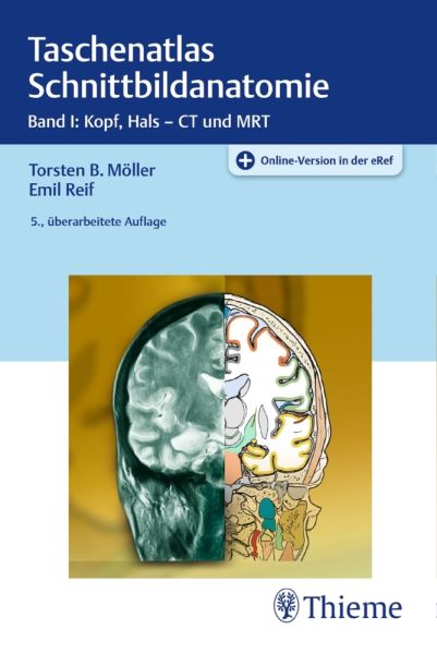 Kopf, Hals: Mit Online-Zugang - Thieme Stuttgart